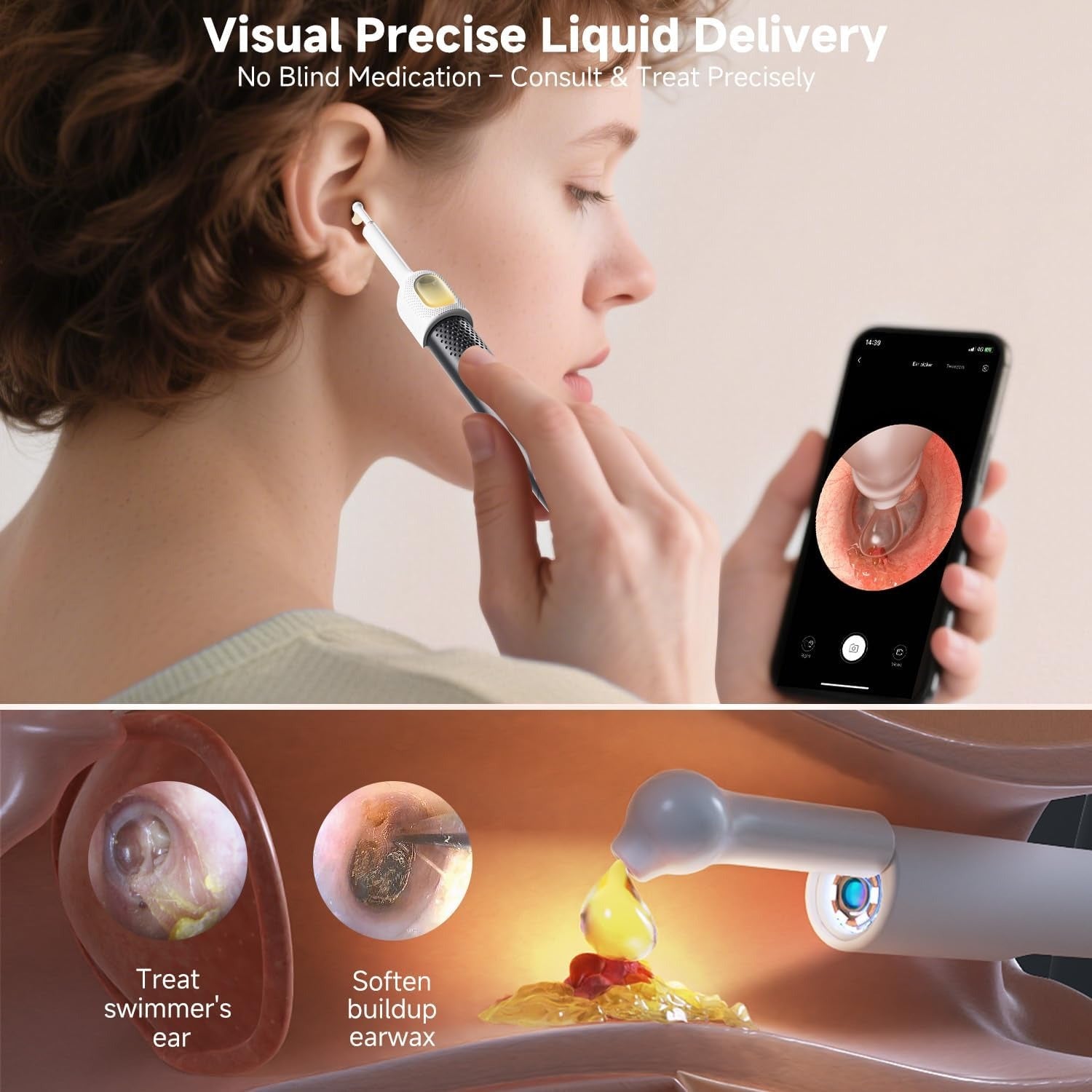 Rechargeable Smart Wireless Ear Camera Kit | Visual Ear Wax Removal Tool With Mobile Display | Random Colour Rechargeable Smart Wireless Ear Camera Kit | Visual Ear Wax Removal Tool With Mobile Display | Random Colour