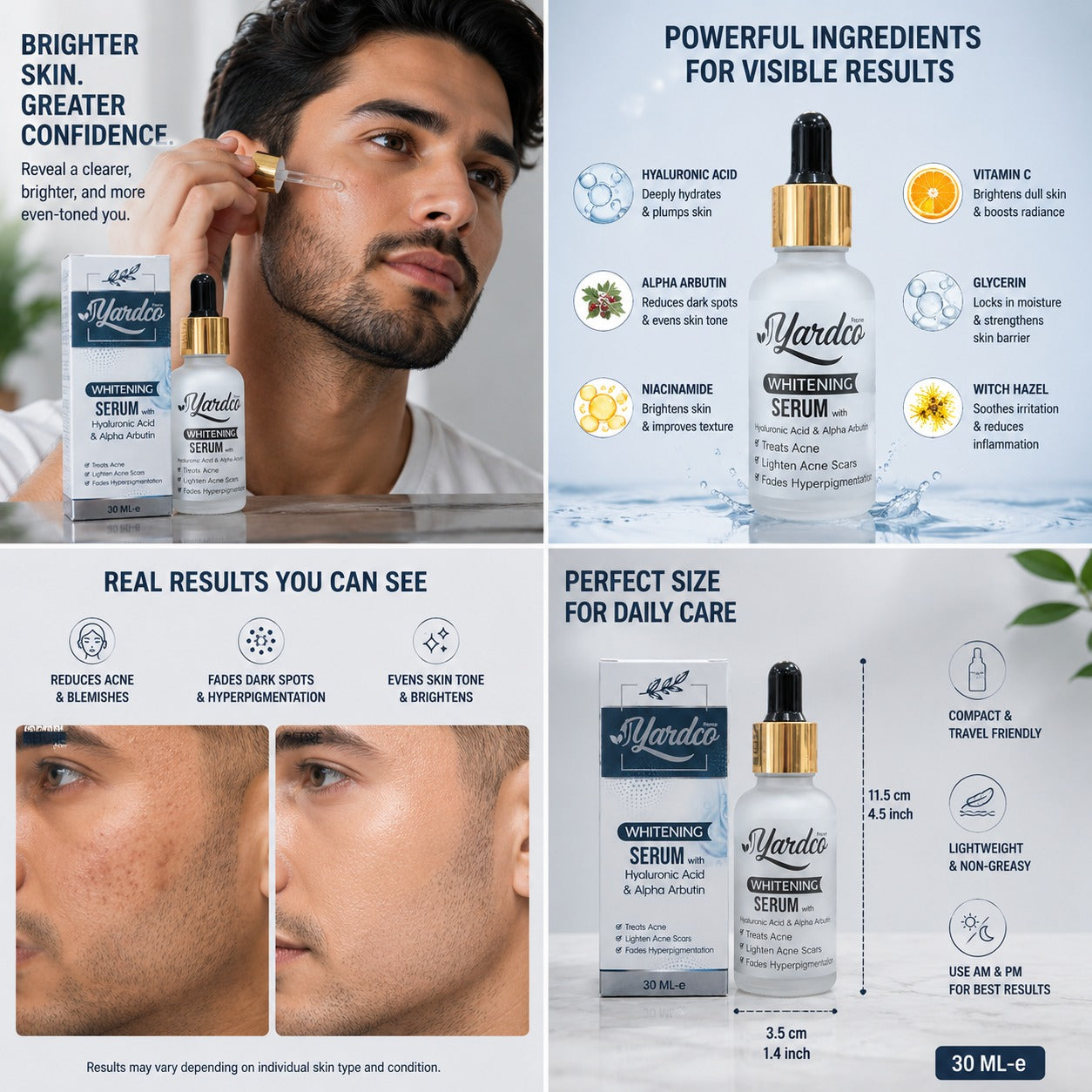 Yardco Whitening Serum With Hyaluronic Acid And Alpha Arbutin Anti Acne And Dark Spot Corrector For Men 30ml Yardco Whitening Serum With Hyaluronic Acid And Alpha Arbutin Anti Acne And Dark Spot Corrector For Men 30ml