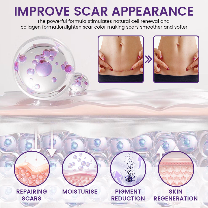 Timilk Regenscar Stem Cell Scar Gel 20g Triple Action Formula For Old And New Scars Surgical Marks Skin Renewal Timilk Regenscar Stem Cell Scar Gel 20g Triple Action Formula For Old And New Scars Surgical Marks Skin Renewal